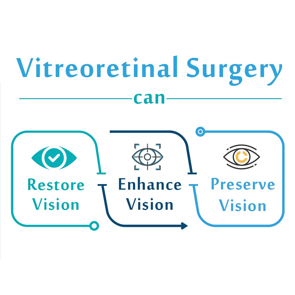 Vitreoretinal surgery vision