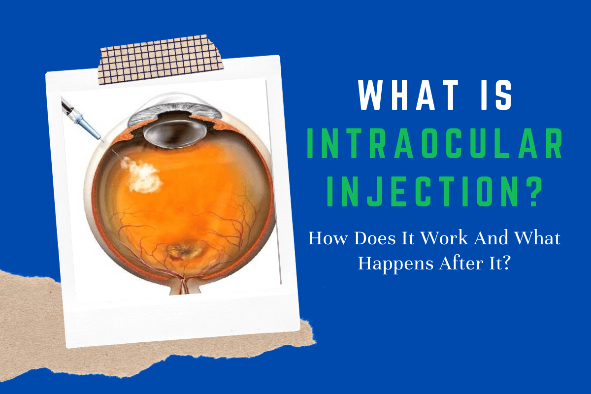 What Is Intraocular Injection