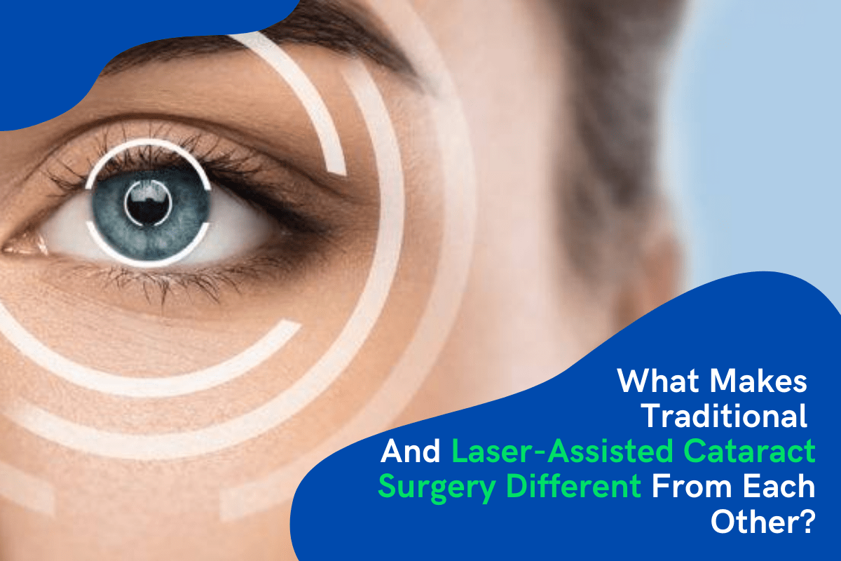 What Makes Traditional And Laser-Assisted Cataract Surgery Different From Each Other