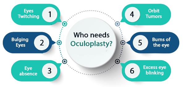 Who needs Oculoplasty