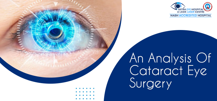 Before, During, And After Procedure Of Cataract Eye Treatment