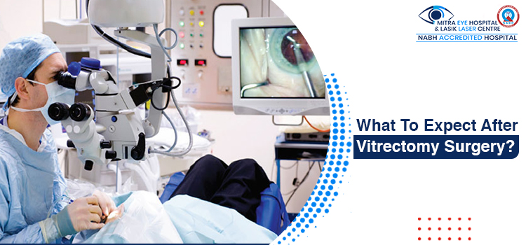 What To Expect After Vitrectomy Surgery