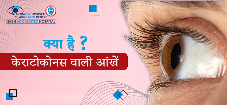 केराटोकोनस वाली आँखे लेसिक (LASIK) सर्जरी की मदद से कैसे ठीक की जाती है ?