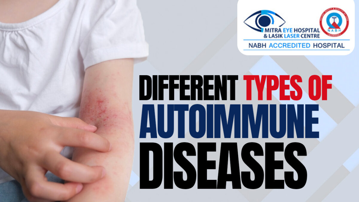 Different types of autoimmune diseases